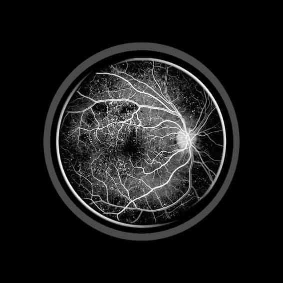 Narcoiris — Temporal