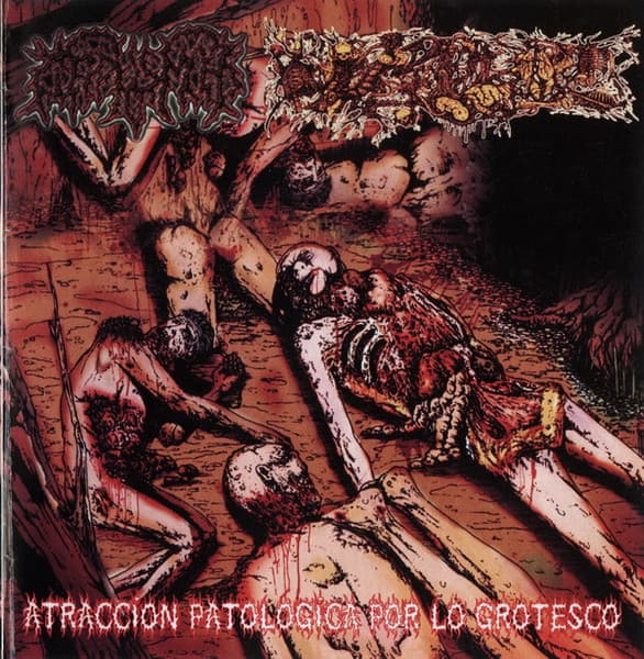 Corpus Mors & Paracoccidioidomicosisproctitissarcomucosis — Atraccion Patologica Por Lo Grotesco