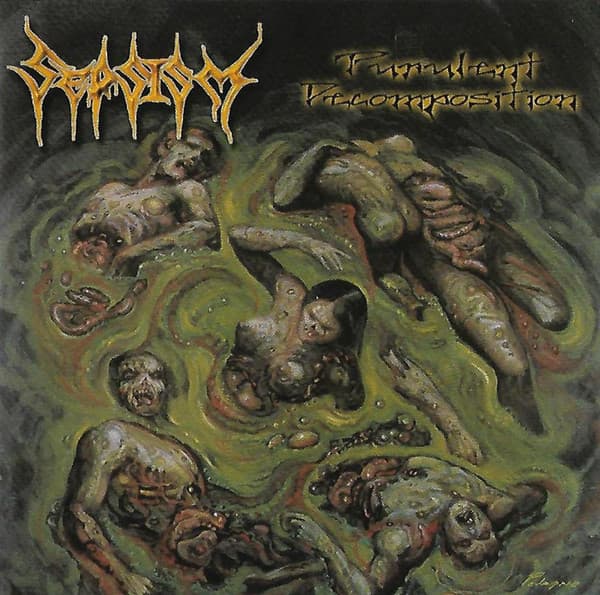 Sepsism — Purulent Decomposition